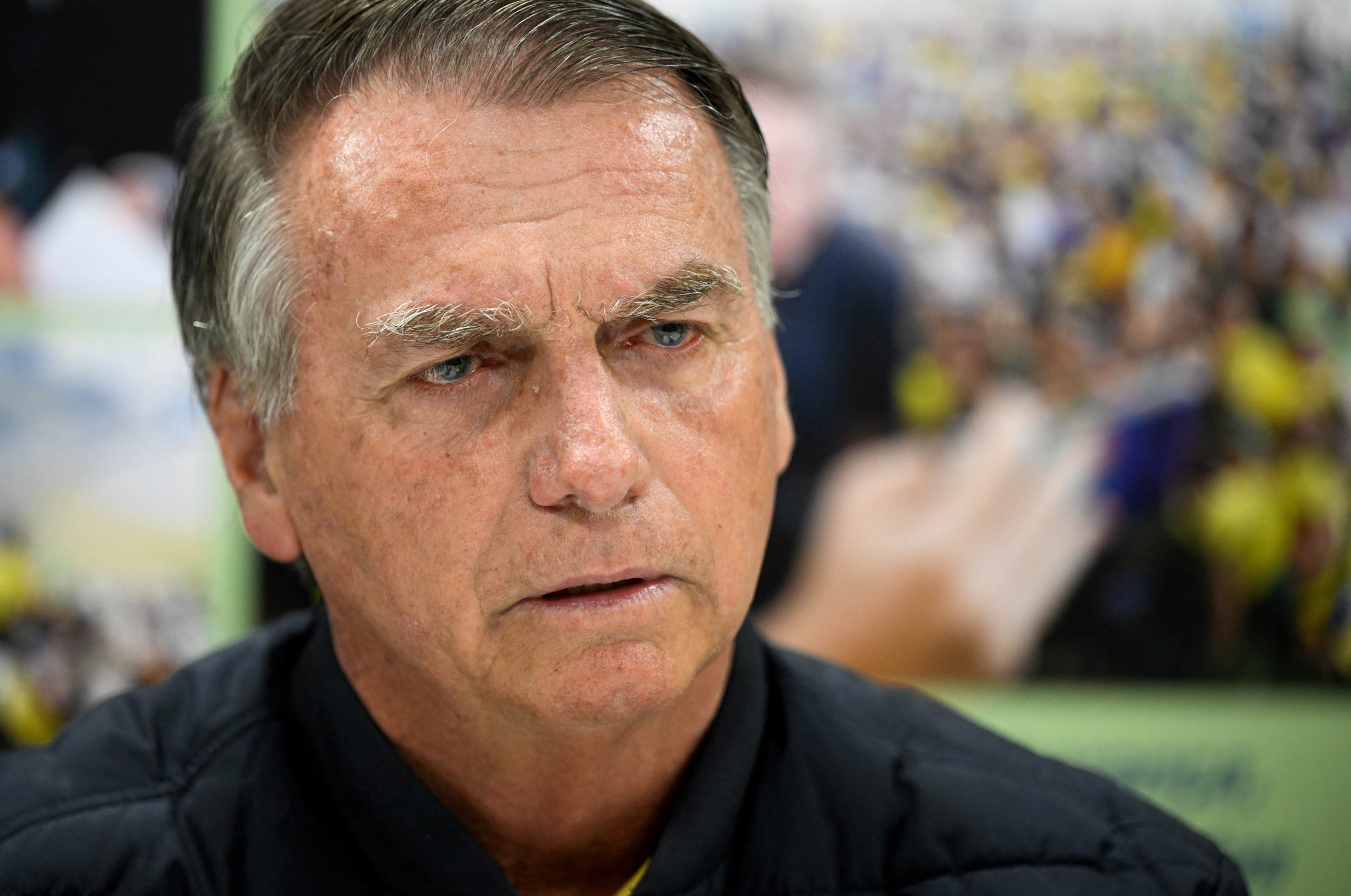 Bolsonaro é liberado de hospital após exames apontam quadro de gastrite e esofagite