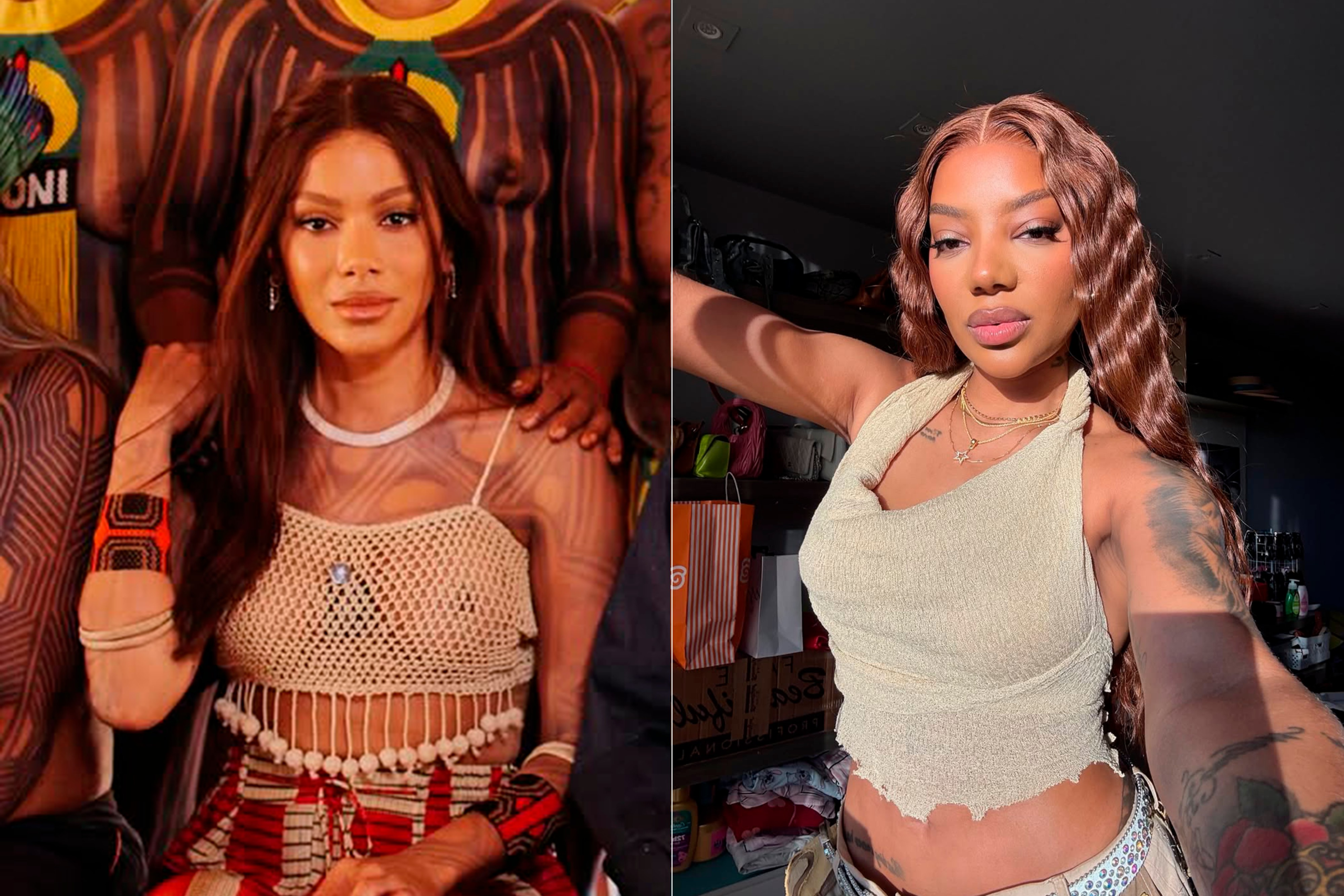 Novo rosto de Anitta revive debate sobre padrão estético entre celebridades