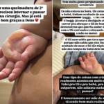 Filho de Viih Tube e Eliezer sofre queimadura na mão e passa por cirurgia