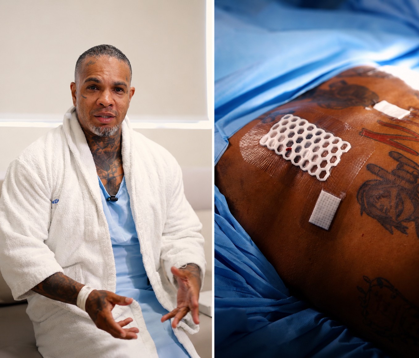 Rodriguinho passa por cirurgia reparadora para retirar excesso de pele Rodriguinho passa por cirurgia reparadora para retirar excesso de pele após emagrecimento
