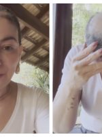 Mãe de Lucas Lucco revela volta de alopecia areata e desabafa nas redes: 'Vou seguir firme'