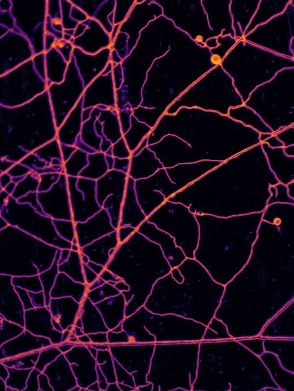 Movimento invisível que nos arrasta é dança do progresso e do fascismo